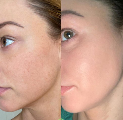 pro power peel-richmond victoria-miss morpho