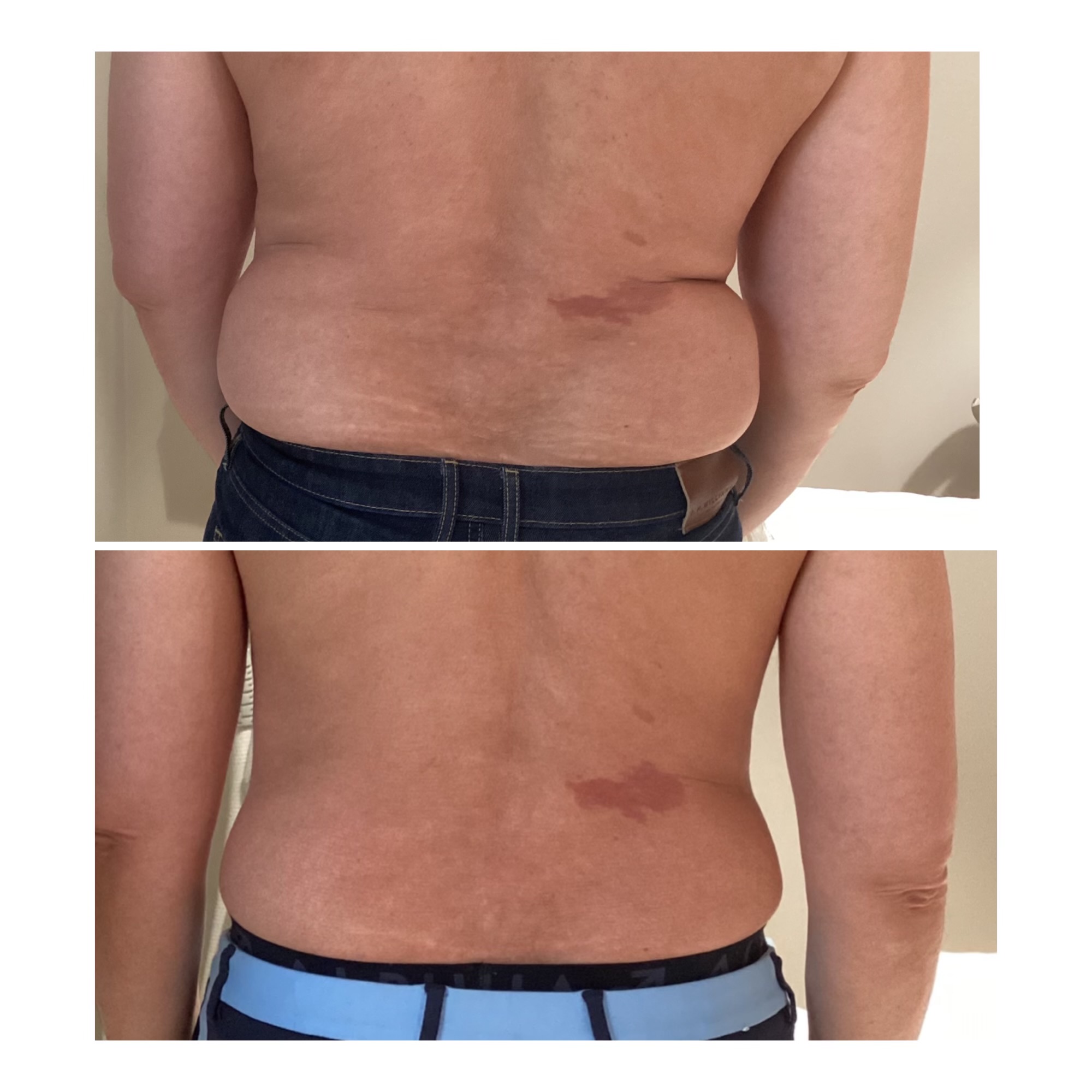skin spot